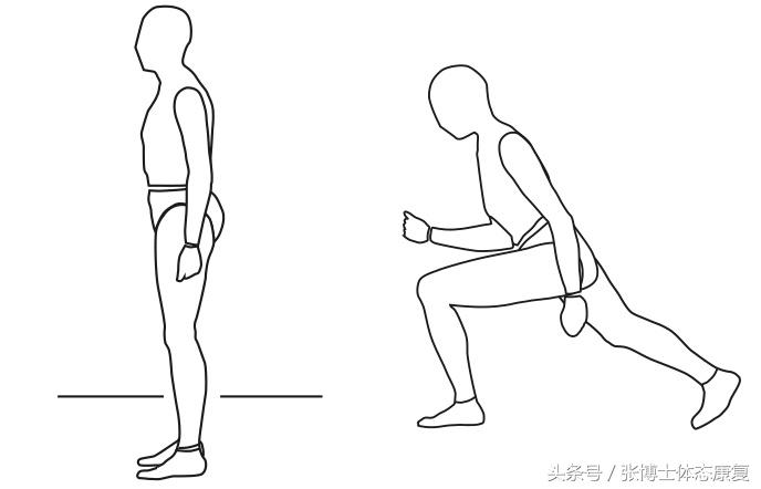 acl前交叉韧带重建康复,acl韧带重建