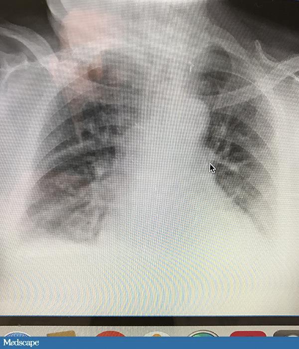 国外抗菌药的合理使用,关于抗菌药你不可错过的科普