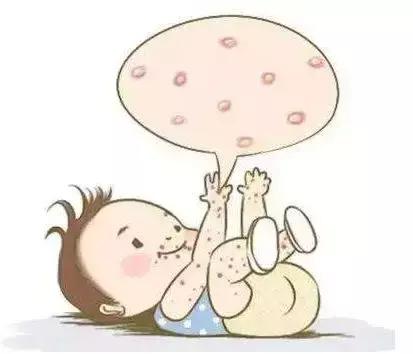 湿疹春捂,幼儿捂出严重的湿疹后果