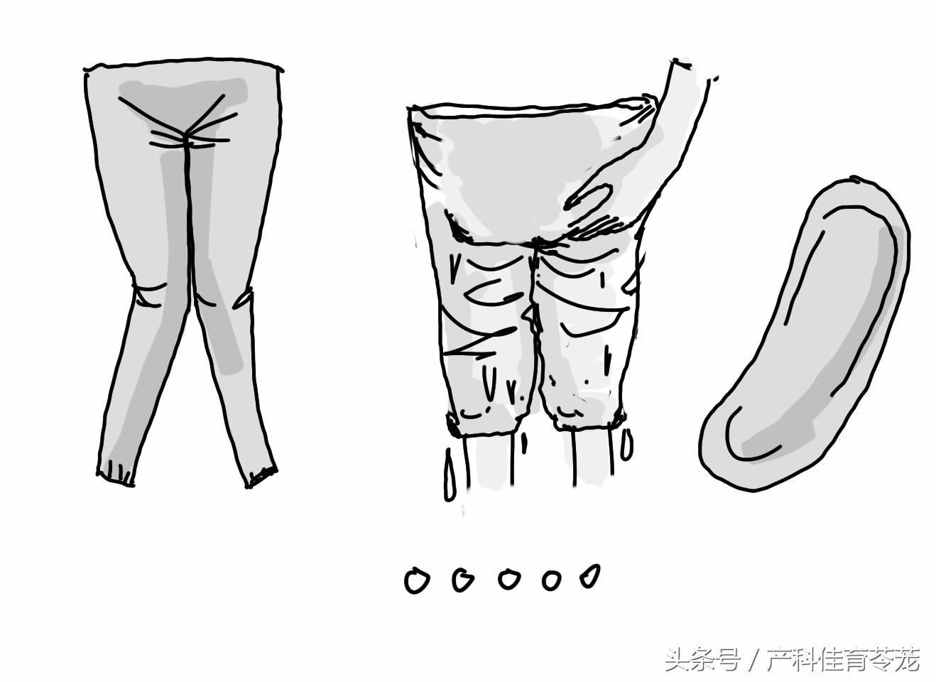 治疗妇科外阴瘙痒用什么洗最好,外阴瘙痒有破溃处擦什么药有效