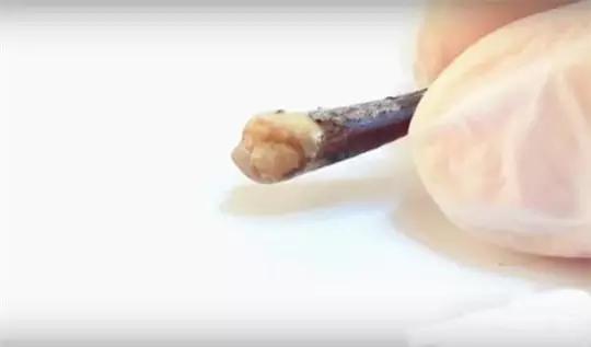 记住这5个关键数字预防骨质疏松,记住这11个秘方健康活过100岁