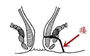 被男医生检查肛门，女生觉得难堪，心里过不去坎……