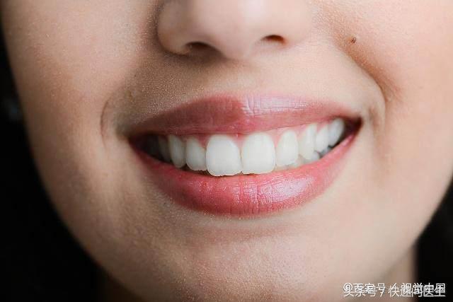 牙齿变白最有效的方法学生党,去口臭口气清新黄牙变白的小方法