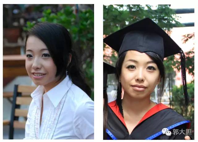 第一次整容日记,整容日记最经典的一段