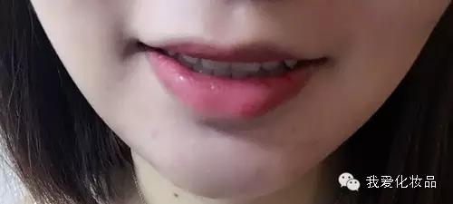 油皮痘肌适合的护肤品牌子,混油皮痘肌适用的护肤品推荐