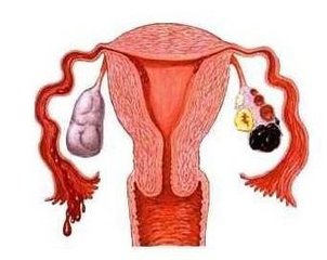 巧囊痛经宝颗粒,痛经准备要孩子做什么理疗