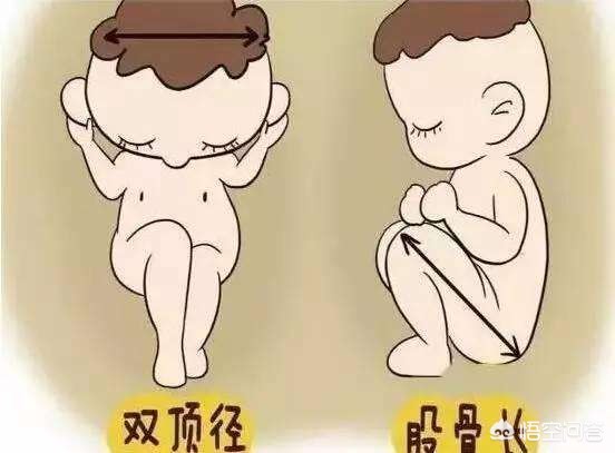 看双顶径和股骨长准吗,b超单子看双顶径和股骨长准吗