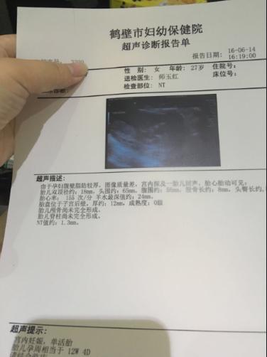 促排过程中卵破了,促排多囊卵巢破裂