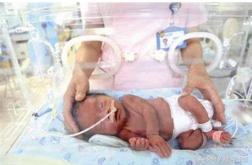 前置胎盘老是出血能保胎到足月吗,中央型胎盘前置保胎经历