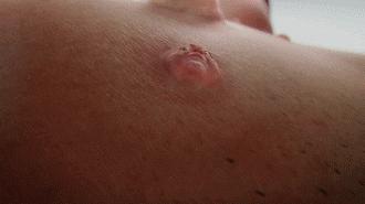 祛痘的尽头,祛痘的尽头是什么