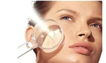 容易长斑的人是什么体质,最易长斑的5个时期