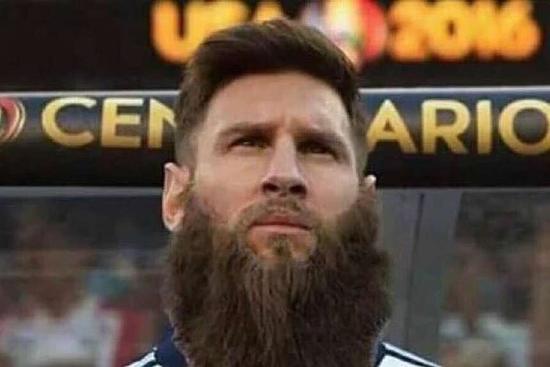 梅西得了什么病,梅西焦虑抑郁