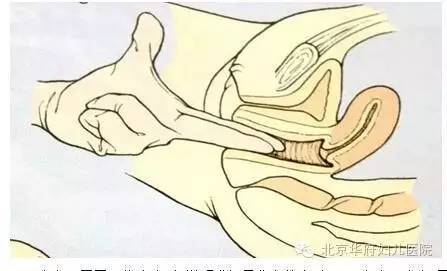 “开十指”是什么意思孕妈们误解了吗？