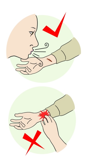 这种小虫子有这么厉害?还能要死人?