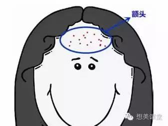 脸再美妆再浓，一颗痘痘毁你容！