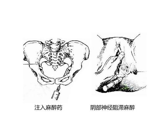 产后顺产妈妈要注意什么问题,侧切妈妈怎么恢复