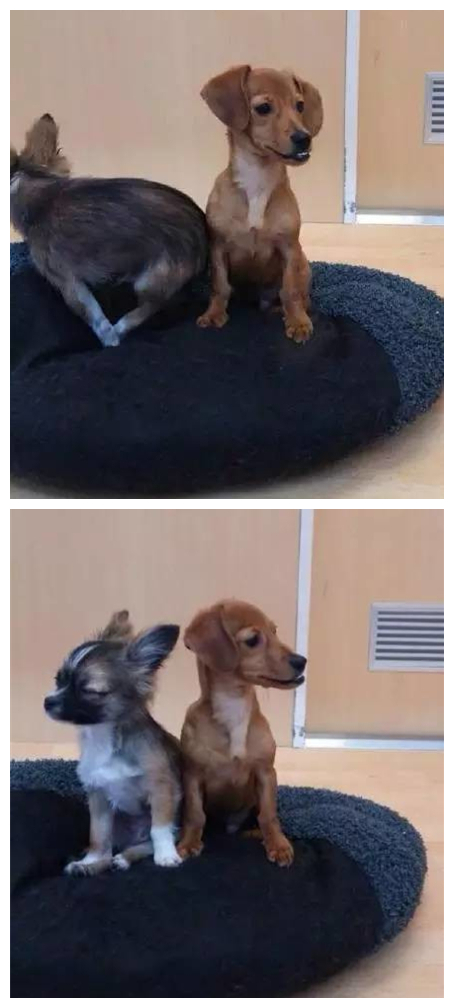 牙齿地包天可以自己咬回来吗,孩子牙齿地包天矫正最佳时间