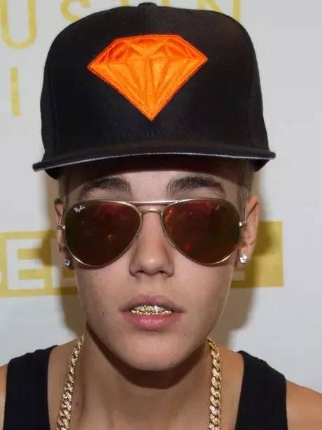 关于最近超火的金牙,你要知道这4件事(起码要知道怎么戴上去吧)