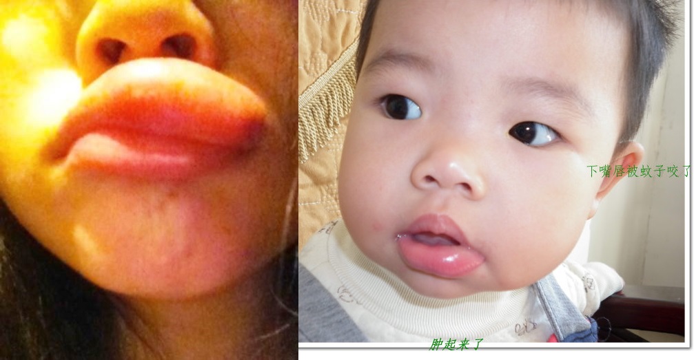 这些部位你有被它侵过么