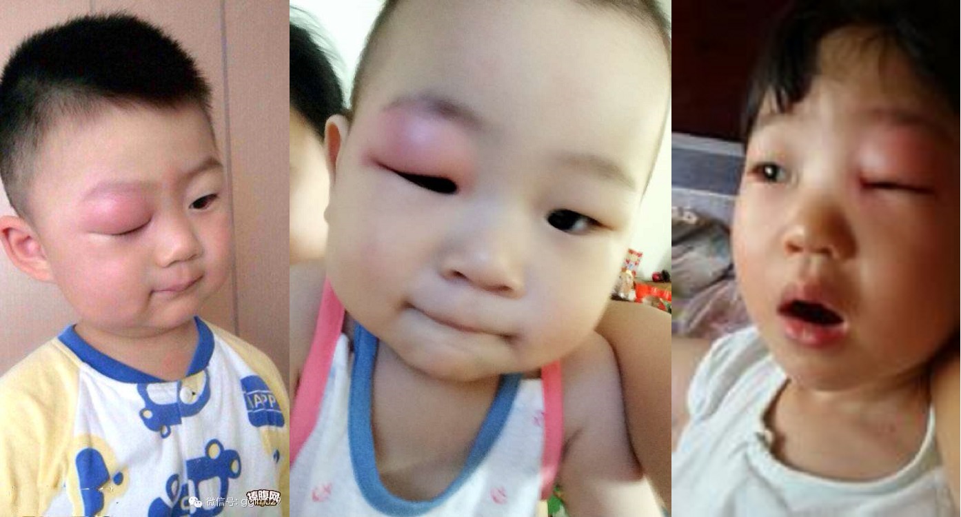 这些部位你有被它侵过么