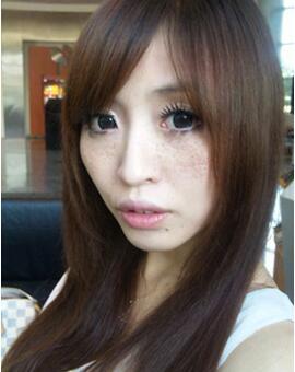 祛斑血泪史真实案例,祛斑血泪史详解