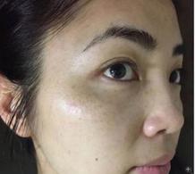 红糖祛斑的偏方有哪些呢,日常祛斑小方法轻松get