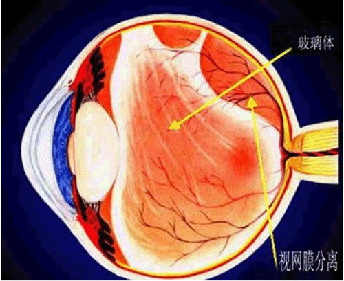 闪光感是正常现象吗,眼有闪光感是什么症状