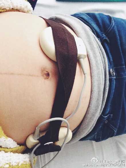 胎儿入盆胎监是不是很平稳,胎儿入盆了但是胎头高