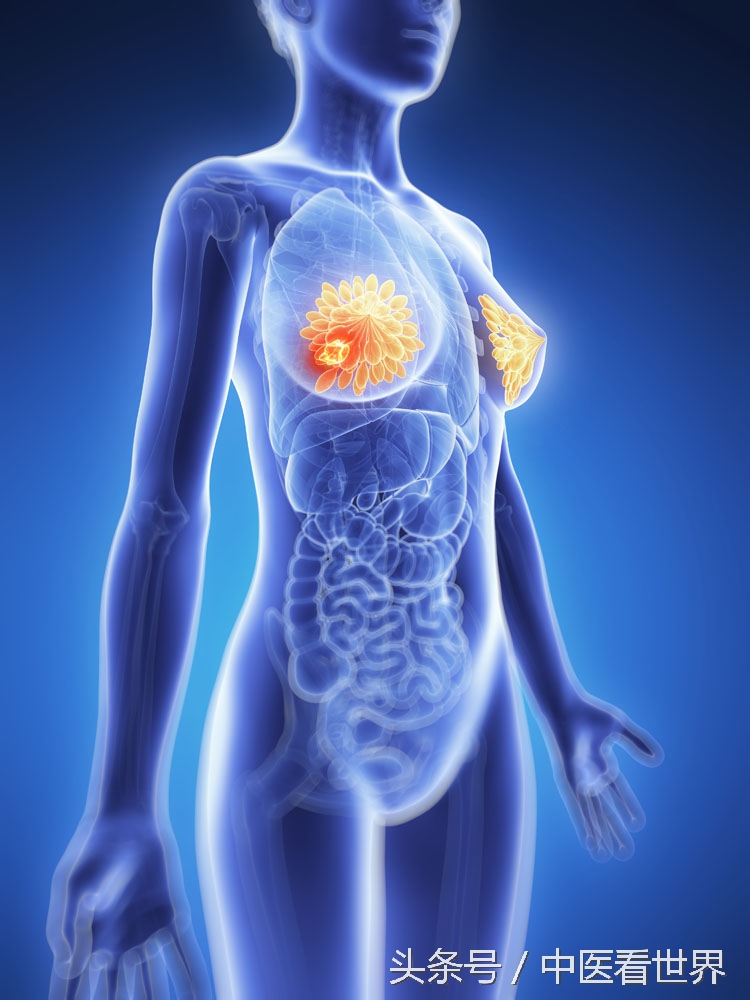 预防乳腺癌的2个小细节,预防乳腺癌的4个真正方法