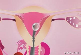 子宫的日常保健法，这样做，包你有一个优质的子宫！