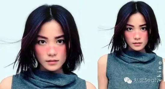 护肤眼睛疼怎么办,护肤晒伤后如何自救