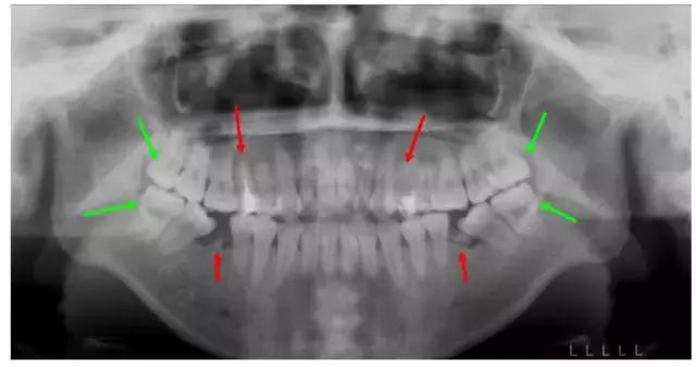 正畸专家介绍图,正畸医生关于整牙的10条建议