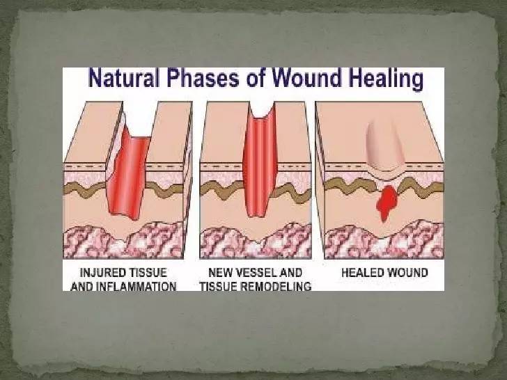 手术后多久可以洗浴,医生手术后多久补充病历