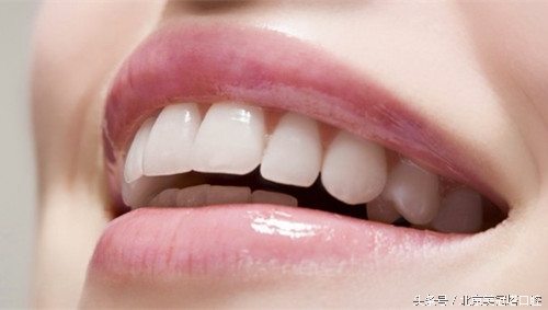 到底应不应该做烤瓷牙,来自医生的忠告不要随便做烤瓷牙