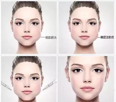 青霉素过敏可以注射胸腺肽吗,青霉素过敏可以注射肉毒素吗