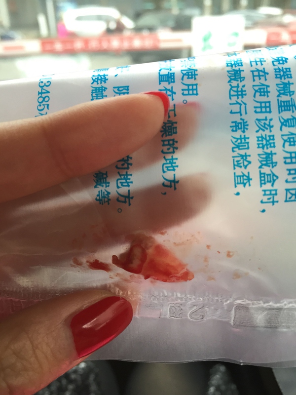 拔牙到底有多惨,拔牙都有什么有趣的经历