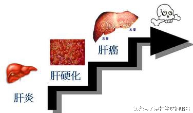 再拖,肝病患者久拖不治,小心命在旦夕...