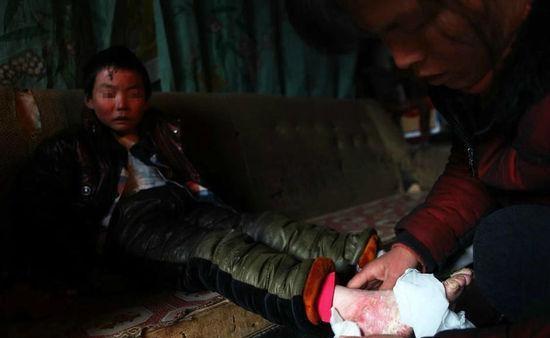 8岁男孩身患怪病,男孩患怪病的真实案例