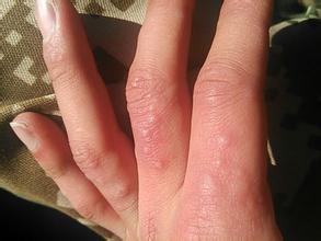 8岁男孩身患怪病,男孩患怪病的真实案例