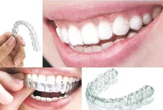 helen鐗欏尰,helen鐗欑