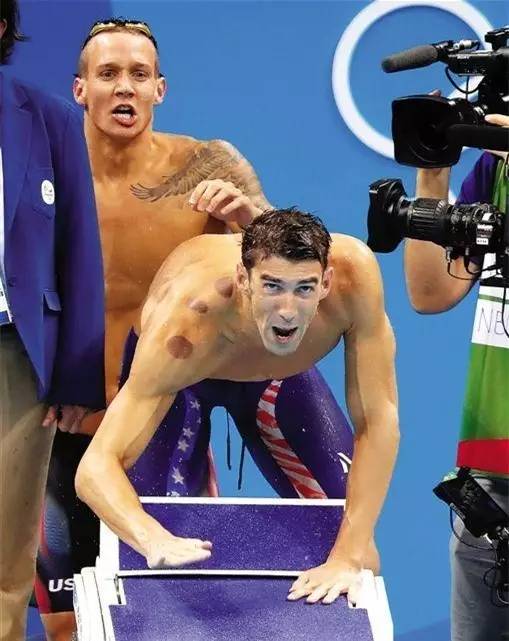 作为一个有同样爱好的老陕我必须提醒菲尔普斯:拔罐后不能下水！