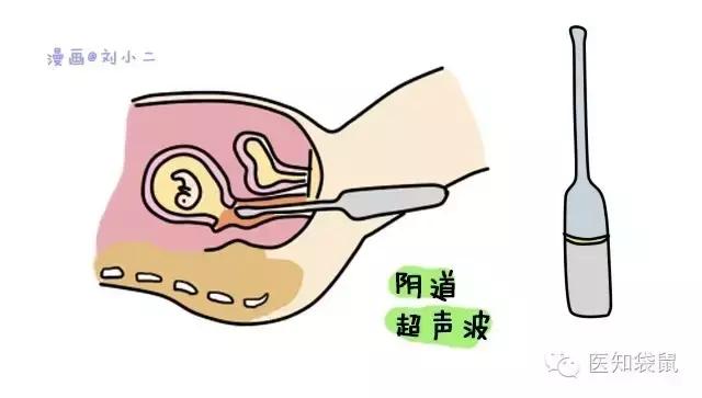 B超三维彩超区别,普通b超能看清胎儿颅内结构吗