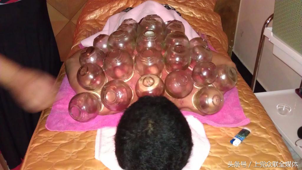 拔火罐神秘的东方力量,迪拜土豪体验东方秘术拔火罐