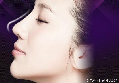 隆鼻什么时候出现淤青,隆鼻后山根要淤青多久