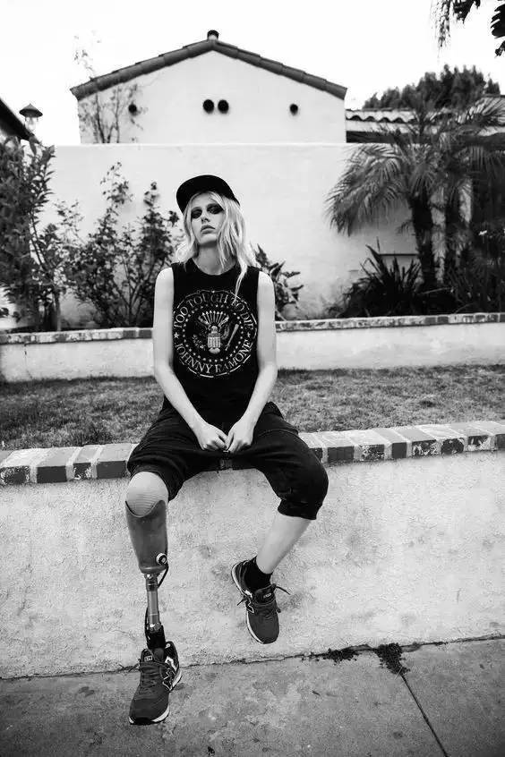 卫生棉会引发炎症吗,卫生棉中毒死亡事件