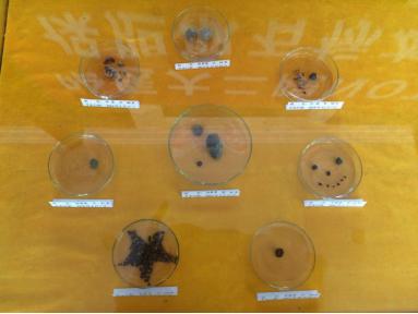 notes手术弊端,notes妇科手术模拟