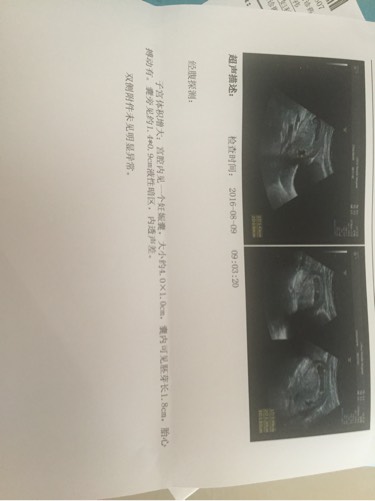 孕酮低未见胚胎什么情况,孕酮低无胎心见红腹痛