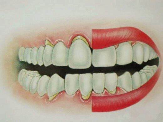 飞利浦电动牙刷推荐真实测评,飞利浦电动牙刷入门和高端的区别