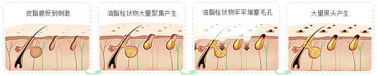 去黑头小技巧外国人,去黑头不需要任何工具的方法