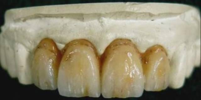 章子怡眼神杀,章子怡吓得宋丹丹尖叫